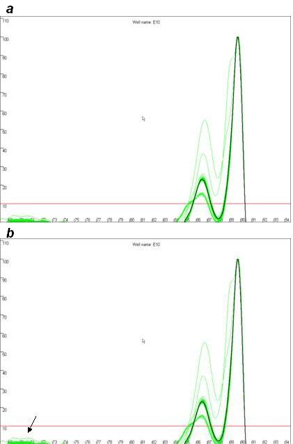 Figure 18